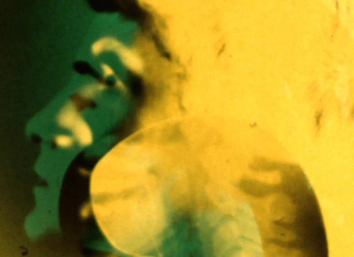 Corps troubles, peaux d'argent #2 | Organes, chair, cicatrices